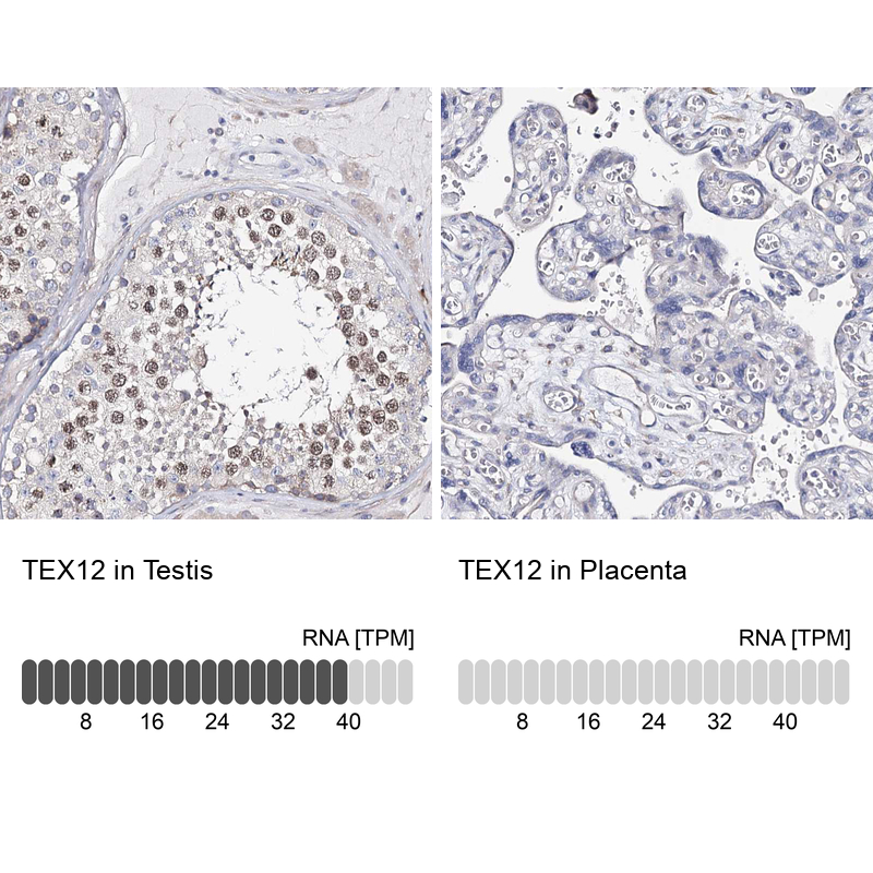 Anti-TEX12 Antibody