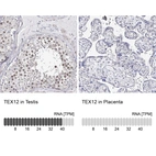 Anti-TEX12 Antibody