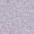 Immunohistochemical staining of human pancreas shows no positivity in exocrine glandular cells as expected.