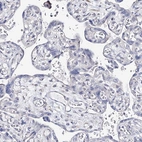 Immunohistochemical staining of human placenta shows no positivity in trophoblastic cells as expected.