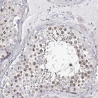 Immunohistochemical staining of human testis shows nuclear positivity in spermatids.