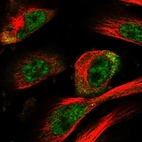 Immunofluorescent staining of human cell line U-251 MG shows localization to nucleoplasm & cytosol.