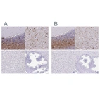 Immunohistochemical staining of human cerebellum, cerebral cortex, liver and prostate using Anti-ERMN antibody HPA038295 (A) shows similar protein distribution across tissues to independent antibody HPA038296 (B).