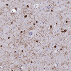 Immunohistochemical staining of human cerebral cortex shows strong cytoplasmic positivity in oligodendrocytes.
