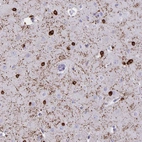 Immunohistochemical staining of human cerebral cortex shows strong cytoplasmic positivity in oligodendrocytes.