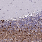 Immunohistochemical staining of human cerebellum shows strong positivity in oligodendrocytes.