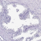 Immunohistochemical staining of human prostate shows no positivity in glandular cells as expected.