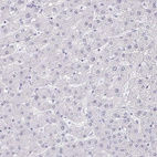 Immunohistochemical staining of human liver shows no positivity in hepatocytes as expected.
