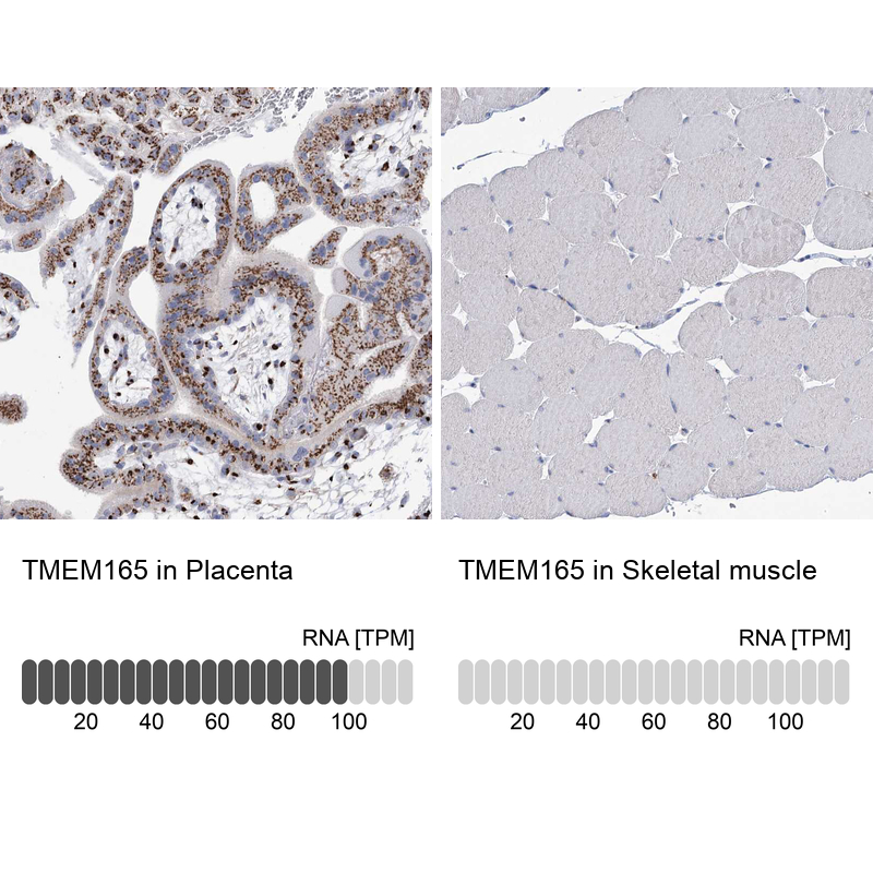 Anti-TMEM165 Antibody