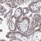 Immunohistochemical staining of human Placenta shows strong granular cytoplasmic positivity in trophoblastic cells.