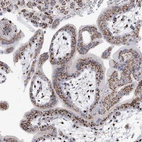 Immunohistochemical staining of human Placenta shows strong granular cytoplasmic positivity in trophoblastic cells.