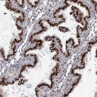 Immunohistochemical staining of human Endometrium shows strong granular cytoplasmic positivity in glandular cells.