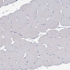 Immunohistochemical staining of human Skeletal muscle shows very weak granular cytoplasmic positivity in myocytes.