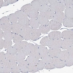 Immunohistochemical staining of human Skeletal muscle shows very weak granular cytoplasmic positivity in myocytes.