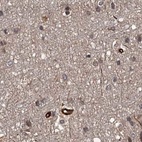 Immunohistochemical staining of human cerebral cortex using Anti-RPAP3 antibody HPA038312.