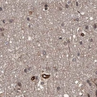 Immunohistochemical staining of human cerebral cortex using Anti-RPAP3 antibody HPA038312.