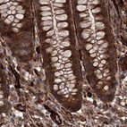 Immunohistochemical staining of human colon using Anti-RPAP3 antibody HPA038312.