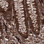 Immunohistochemical staining of human colon using Anti-RPAP3 antibody HPA038312.