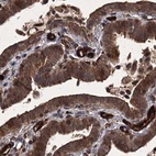 Immunohistochemical staining of human fallopian tube using Anti-RPAP3 antibody HPA038312.