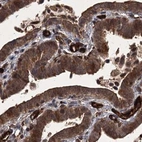 Immunohistochemical staining of human fallopian tube using Anti-RPAP3 antibody HPA038312.