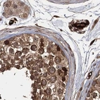 Immunohistochemical staining of human testis using Anti-RPAP3 antibody HPA038312.