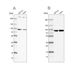 Western blot analysis using Anti-RPAP3 antibody HPA038312 (A) shows similar pattern to independent antibody HPA038311 (B).