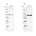 Western blot analysis using Anti-RPAP3 antibody HPA038312 (A) shows similar pattern to independent antibody HPA038311 (B).