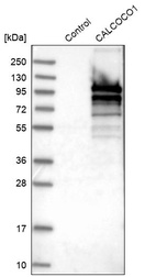 Western blot analysis in control (vector only transfected HEK293T lysate) and CALCOCO1 over-expression lysate (Co-expressed with a C-terminal myc-DDK tag (~3.1 kDa) in mammalian HEK293T cells, LY412204).