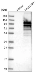 Western blot analysis in control (vector only transfected HEK293T lysate) and CALCOCO1 over-expression lysate (Co-expressed with a C-terminal myc-DDK tag (~3.1 kDa) in mammalian HEK293T cells, LY412204).