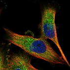 Immunofluorescent staining of human cell line U-251 MG shows localization to cytosol.