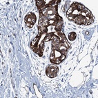Anti-CALCOCO1 Antibody