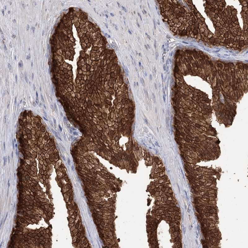 Anti-R3HDM2 Antibody
