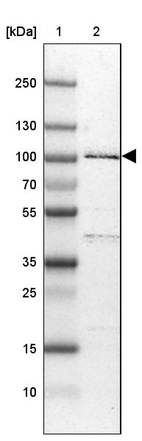 Anti-R3HDM2 Antibody