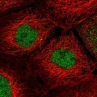 Immunofluorescent staining of human cell line A-431 shows localization to nucleoplasm.