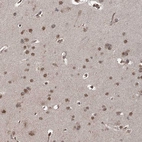 Anti-ZCCHC24 Antibody