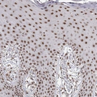Immunohistochemical staining of human skin shows moderate nuclear positivity in squamous epithelial cells.