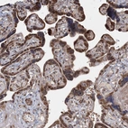 Immunohistochemical staining of human placenta shows moderate nuclear positivity in trophoblastic cells.