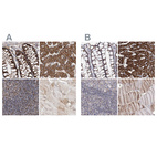 Immunohistochemical staining of human colon, liver, lymph node and skeletal muscle using Anti-NADK2 antibody HPA038366 (A) shows similar protein distribution across tissues to independent antibody HPA038367 (B).