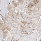 Immunohistochemical staining of human skeletal muscle shows low expression as expected.