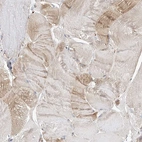 Immunohistochemical staining of human skeletal muscle shows low expression as expected.