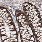 Immunohistochemical staining of human colon using Anti-NADK2 antibody HPA038366.