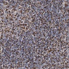 Immunohistochemical staining of human lymph node using Anti-NADK2 antibody HPA038366.