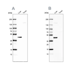 Western blot analysis using Anti-NADK2 antibody HPA038366 (A) shows similar pattern to independent antibody HPA038367 (B).