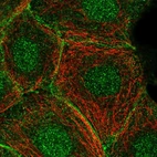 Immunofluorescent staining of human cell line MCF7 shows localization to nucleus & cell junctions.