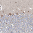 Anti-ARHGAP32 Antibody
