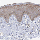 Immunohistochemical staining of human skin shows weak to moderate cytoplasmic positivity in squamous epithelial cells.