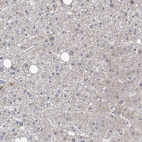 Immunohistochemical staining of human liver shows no positivity in hepatocytes as expected.