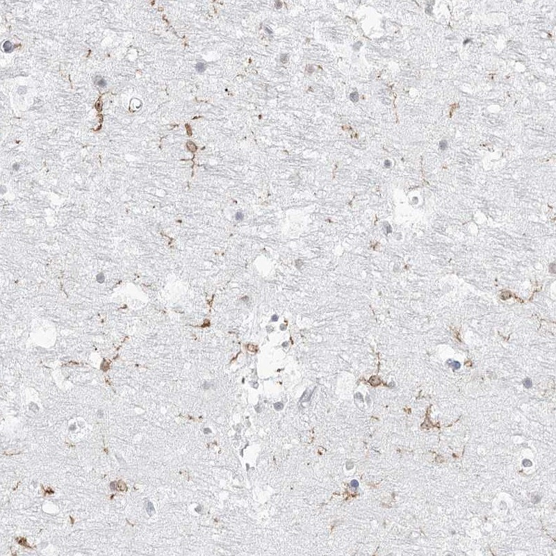 Anti-C11orf1 Antibody