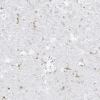 Anti-C11orf1 Antibody