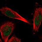 Anti-C11orf1 Antibody